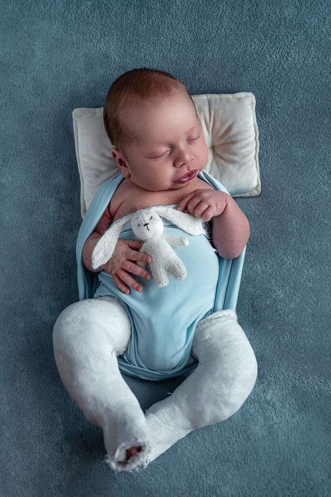 Séance photo nouveau né , bébé plâtre aux jambes 