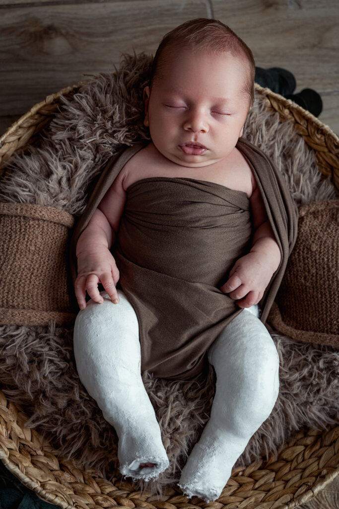 Séance photo nouveau né , bébé plâtre aux jambes 